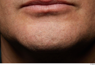  HD Face skin references Lukas Mina lips mouth skin pores skin texture 0007.jpg